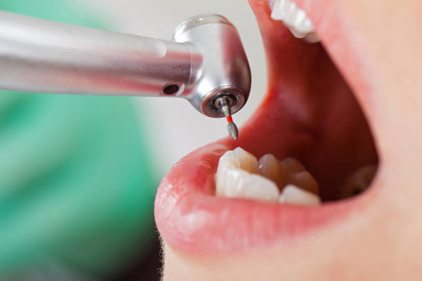 Best Emergency Root Canal Treatment in Man, WV